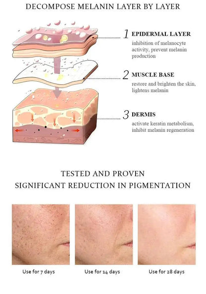 BELYN BERLY – Brighten & Acne Clear serumų rinkinys