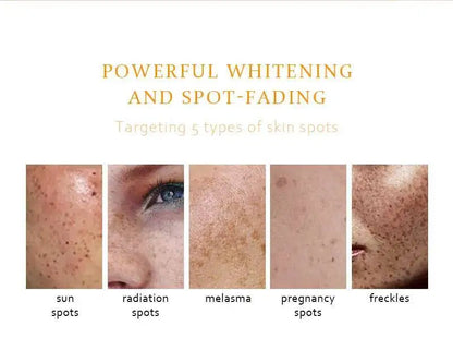 BELYN BERLY – Brighten & Acne Clear serumų rinkinys