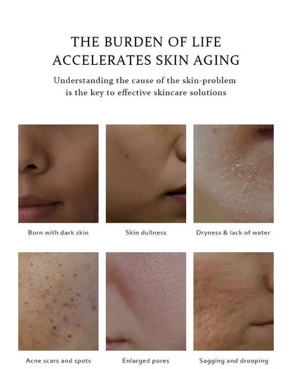 BELYN BERLY – Brighten & Acne Clear serumų rinkinys